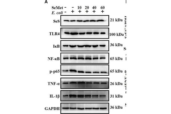 NF-kB p65 antibody  (pSer536)