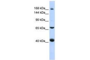 Image no. 1 for anti-ATP-Binding Cassette, Sub-Family C (CFTR/MRP), Member 9 (ABCC9) (AA 1440-1489) antibody (ABIN6740836) (ABCC9 antibody  (AA 1440-1489))