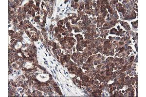 Image no. 6 for anti-F-Box Protein 21 (FBXO21) antibody (ABIN1498232) (FBXO21 antibody)