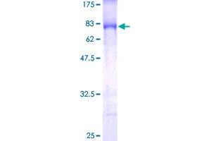 Image no. 1 for Inhibitor of kappa Light Polypeptide Gene Enhancer in B-Cells, Kinase gamma (IKBKG) (AA 1-419) protein (GST tag) (ABIN1307644) (IKBKG Protein (AA 1-419) (GST tag))