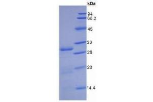 SDS-PAGE (SDS) image for Dipeptidyl-Peptidase 4 (DPP4) ELISA Kit (ABIN6574231)