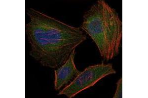 Immunofluorescence analysis of HeLa cells using TNNI2 monoclonal antobody, clone 2F12G2  (green).