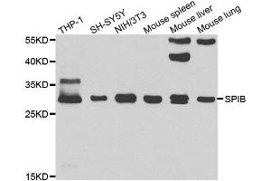 Western blot analysis of extracts of various cell lines, using SPIB antibody. (SPIB antibody)
