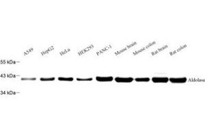 Western blot analysis of ALDA (ABIN7073005) at dilution of 1: 500 (Aldolase antibody)