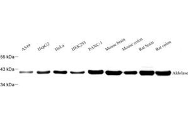 Aldolase antibody