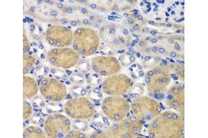 Immunohistochemistry of paraffin-embedded Mouse kidney using SND1 Polyclonal Antibody at dilution of 1:100 (40x lens). (SND1 antibody)