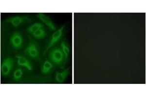 Immunofluorescence analysis of HeLa cells, using CDH23 Antibody. (CDH23 antibody  (AA 61-110))