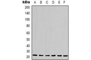 Western blot analysis of Cyclophilin B expression in Hela (A), Jurkat (B), 293T (C), HepG2 (D), NIH3T3 (E), rat liver (F) whole cell lysates. (PPIB antibody)