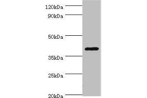 Western blot All lanes: HDAC11 antibody at 2 μg/mL + Mouse brain tissue Secondary Goat polyclonal to rabbit IgG at 1/10000 dilution Predicted band size: 40, 34 kDa Observed band size: 40 kDa (HDAC11 antibody  (AA 1-347))