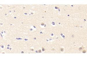 Detection of TNX in Human Cerebrum Tissue using Polyclonal Antibody to Tenascin X (TNX)