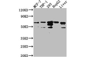 Western Blot Positive WB detected in: MCF-7 whole cell lysate, THP-1 whole cell lysate, 293 whole cell lysate, HepG2 whole cell lysate, Mouse Liver whole cell lysate All lanes: FAAH1 Antibody at 1:1000 Secondary Goat polyclonal to rabbit IgG at 1/50000 dilution Predicted band size: 64 kDa Observed band size: 64 kDa (Recombinant FAAH antibody)