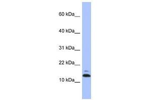 ASAH1 antibody used at 1 ug/ml to detect target protein.