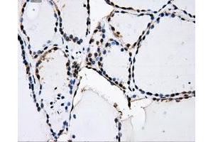 Immunohistochemical staining of paraffin-embedded Kidney tissue using anti-PKMYT1mouse monoclonal antibody.