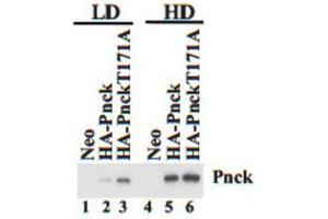 Western Blotting (WB) image for anti-Pregnancy Up-Regulated Non-Ubiquitously Expressed CaM Kinase (PNCK) antibody (ABIN3002987) (PNCK antibody)