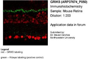 Sample Type: Mouse RetinaPrimary Dilution: 1:200 (GRIK5 antibody  (Middle Region))