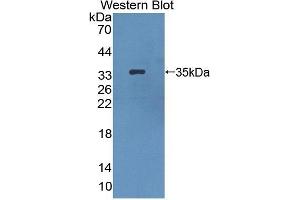 Detection of Recombinant HPS1, Mouse using Polyclonal Antibody to Hermansky Pudlak Syndrome Protein 1 (HPS1) (HPS1 antibody  (AA 1-275))