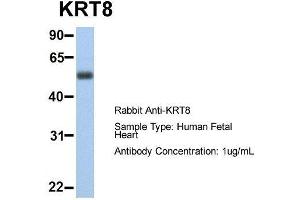 Host:  Rabbit  Target Name:  KRT8  Sample Type:  Human Fetal Heart  Antibody Dilution:  1. (KRT8 antibody  (Middle Region))