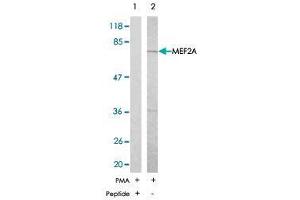 Western blot analysis of extract from NIH/3T3 , using MEF2A polyclonal antibody  . (MEF2A antibody)