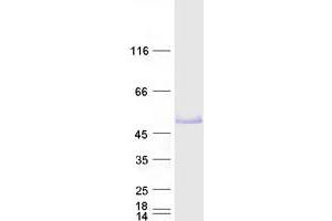 Validation with Western Blot (FOXP3 Protein (Transcript Variant 1) (Myc-DYKDDDDK Tag))