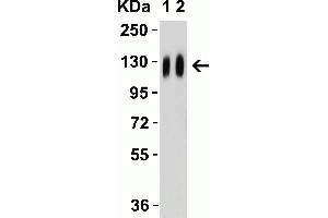 Western Blot Validation with SARS-CoV-2 (COVID-19) Spike Recombinant Protein Loading: 50 ng per lane of SARS-CoV-2 (COVID-19) Spike S1 recombinant protein (97-087.