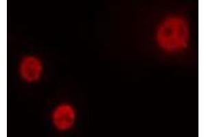 ABIN6274264 staining HeLa cells by IF/ICC. (HOXA1 antibody  (Internal Region))