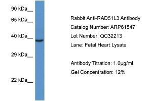 Western Blotting (WB) image for anti-RAD51 Homolog D (RAD51D) (C-Term) antibody (ABIN2788836) (RAD51D antibody  (C-Term))