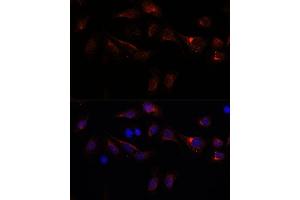 Immunofluorescence analysis of U-2 OS cells using PFDN4 antibody (ABIN7269508) at dilution of 1:100. (PFDN4 antibody  (AA 1-134))