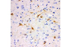 Anti- IP3 receptor antibody, IHC(P): Rat Brain Tissue