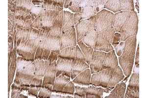 IHC-P Image RSK2 antibody detects RSK2 protein at cytosol and nucleus on mouse muscle by immunohistochemical analysis. (RPS6KA3 antibody  (Center))