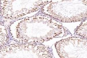 Immunohistochemistry analysis of paraffin-embedded mouse testis using,NUP133 (ABIN7074909) at dilution of 1: 4800 (NUP133 antibody)