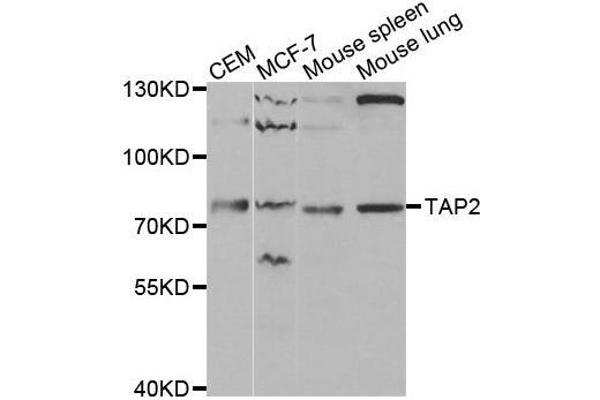 TAP2 anticorps  (AA 430-680)