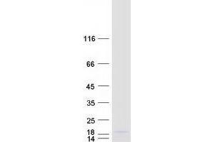 Validation with Western Blot (YPEL1 Protein (Myc-DYKDDDDK Tag))