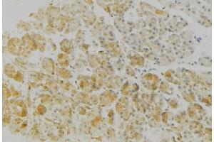ABIN6276762 at 1/100 staining Human gastric tissue by IHC-P. (HLA-DRB3 antibody)