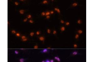 Immunofluorescence analysis of U-251MG cells using PRPF8 Polyclonal Antibody at dilution of 1:100 (20x lens).