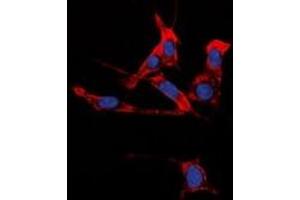 Immunofluorescent analysis of EPHB1/2 staining in HuvEc cells. (EPHB1/2 antibody)