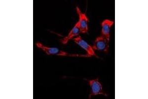 Immunofluorescent analysis of EPHB1/2 staining in HuvEc cells. (EPHB1/2 antibody)