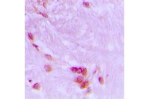 Immunohistochemical analysis of CDC27 staining in human brain formalin fixed paraffin embedded tissue section. (CDC27 antibody  (Center))
