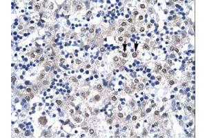 Image no. 2 for anti-Caudal Type Homeobox 4 (CDX4) (C-Term) antibody (ABIN6736267) (CDX4 antibody  (C-Term))