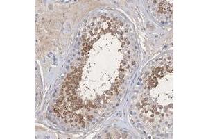 Immunohistochemical staining of human testis with C11orf58 polyclonal antibody  shows moderate cytoplasmic positivity in cells in seminiferus ducts at 1:20-1:50 dilution. (C11ORF58 antibody)