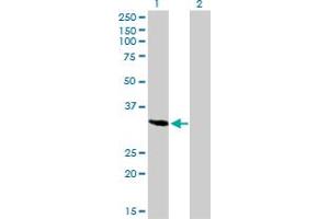 Western Blot analysis of SPARC expression in transfected 293T cell line by SPARC monoclonal antibody (M02), clone 1B2. (SPARC antibody  (AA 1-303))
