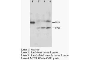 MRGPRC SNSR Polyclonal Antibody (MRGPRC antibody  (N-Term))