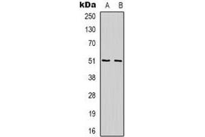 Western blot analysis of WIPF1 expression in Jurkat (A), K562 (B) whole cell lysates.