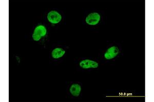 Immunofluorescence of monoclonal antibody to HNRPM on HepG2 cell.