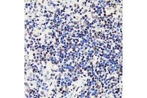 Immunohistochemistry (IHC) image for anti-Histone H2B (acLys5) antibody (ABIN7267733)