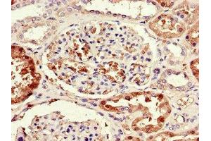 Immunohistochemistry of paraffin-embedded human kidney tissue using ABIN7170330 at dilution of 1:100 (SORD antibody  (AA 201-357))