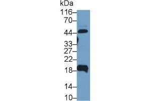 Detection of UPK2 in Human Urine using Polyclonal Antibody to Uroplakin 2 (UPK2) (Uroplakin 2 antibody  (AA 26-153))