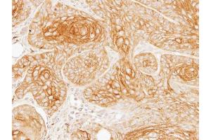 Immunohistochemistry (IHC) image for anti-Galactosidase, alpha (GLA) antibody (ABIN2854962)