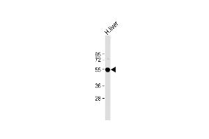 Anti-FADS2 Antibody at 1:2000 dilution + Human liver lysate Lysates/proteins at 20 μg per lane. (FADS2 antibody)