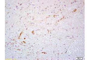 Formalin-fixed and paraffin embedded rat brain labeled with Anti- PROK2/Prokineticin 2 Polyclonal Antibody, Unconjugated  at 1:200 followed by conjugation to the secondary antibody and DAB staining (PROK2 antibody  (AA 28-100))