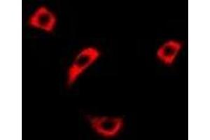 Immunofluorescent analysis of RASSF1 staining in Hela cells. (RASSF1 antibody)